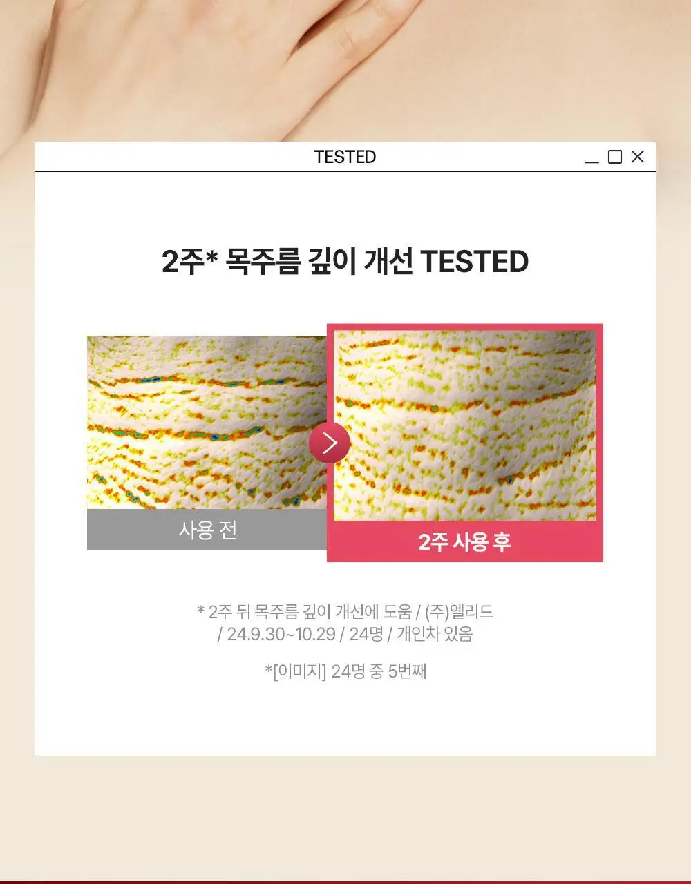 [포켓몬 에디션/5월 올영픽] 비욘드 바디타민 로션 (착색미백/목주름탄력/초보습)기획 3종 택1 상세페이지 87